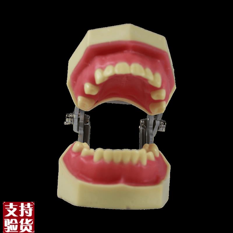 种植模型口腔牙科牙齿模型备牙z练习软牙龈牙模仿真树脂离体缺失