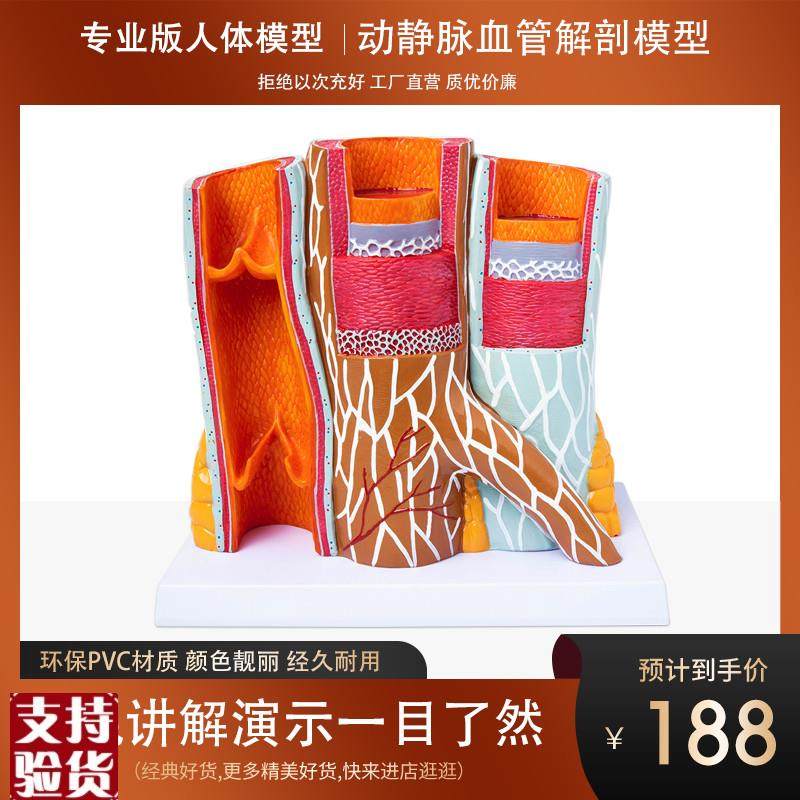政河人体动静脉i血管模型器官解剖放大层次结构演示教学医院学校