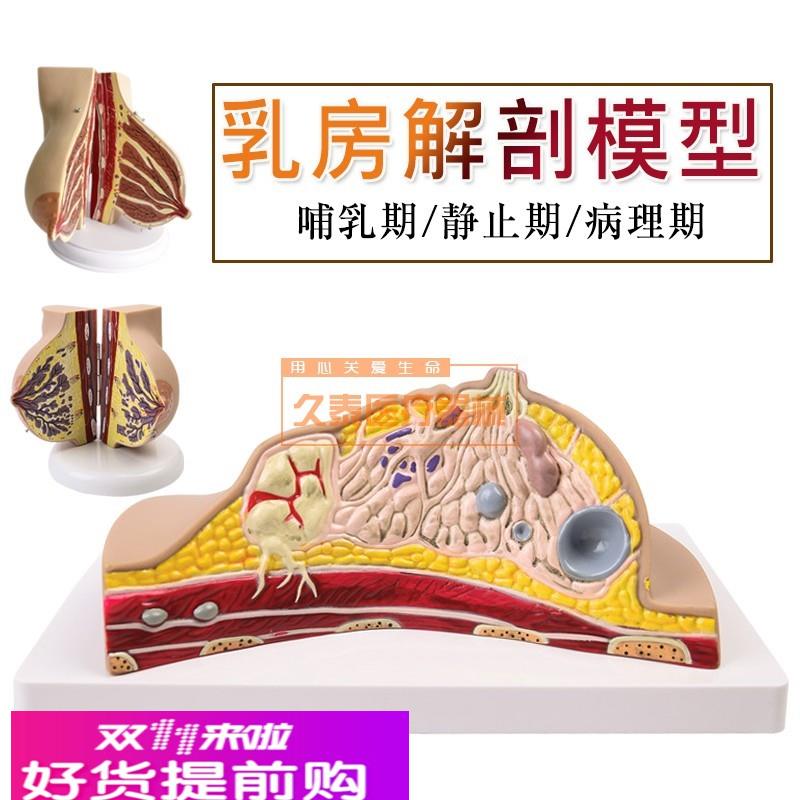 乳房病理模型 乳房病变模型 乳房模型 乳房解剖模型 哺乳培训模型