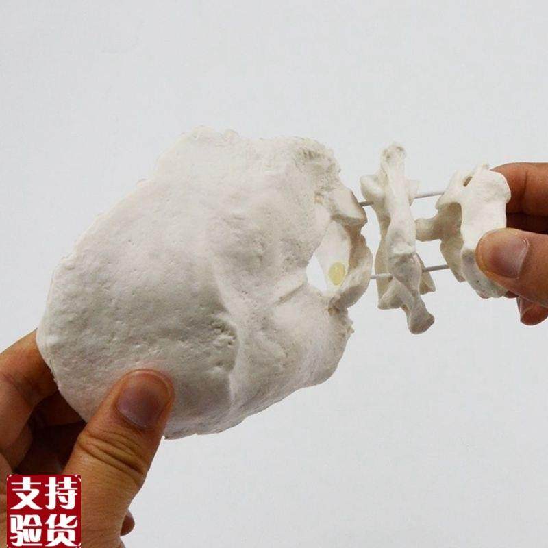 康泰动态颈椎模型寰椎枢椎枕骨旋转错位演示O康复正骨中医颈椎功