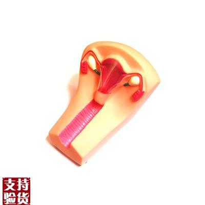 女性宫内避孕及训练模型女性宫内避孕指导模型W计生教育模型