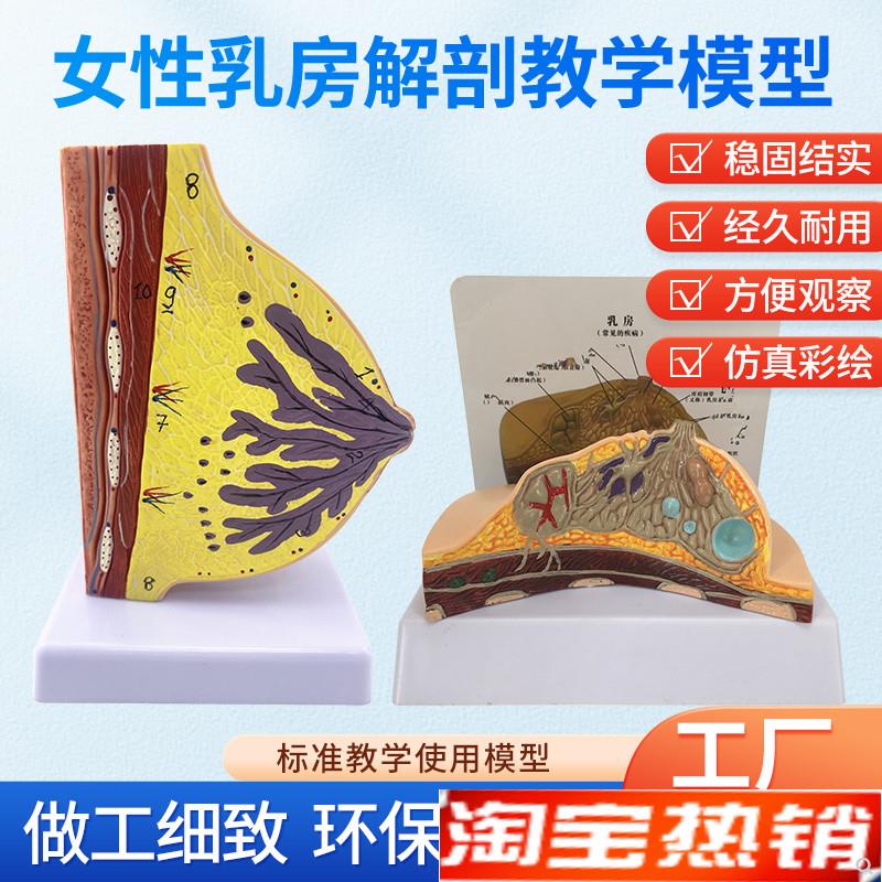 乳房模型乳腺解剖k医用教学模型乳房常见疾病病理解剖结构模型