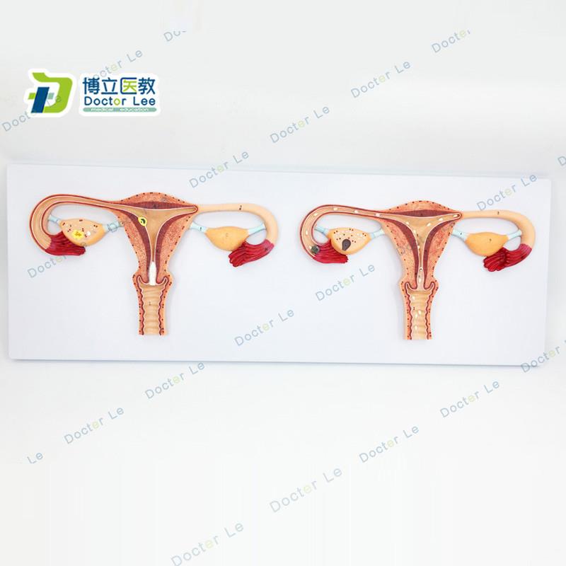 厂家正品直销卵子受精q过程放大模型女性卵子受精及卵子发育输送