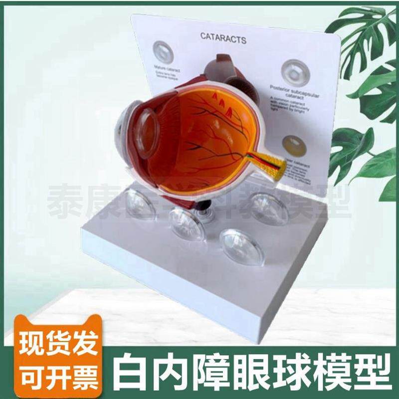 眼科用模b型眼睛白内障模型晶状体浑浊老年人眼球解剖人体眼睛