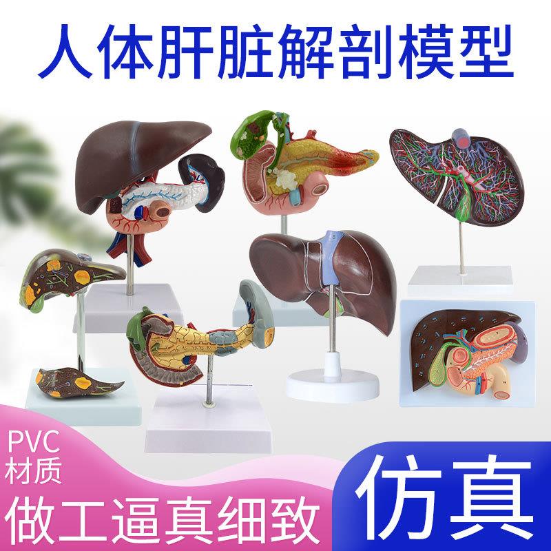 正品仿真人体肝脏模型肝解剖肝胆胰脾十二指肠浮S雕病变肝胆胰模