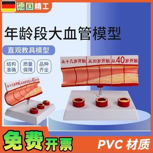 德国】年龄段大血管模c型4部件/硬化心血管动脉/硬化模型血管病