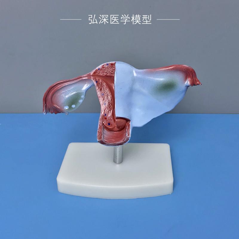女性子宫模型人体生m殖系统器官解剖卵巢输卵管妇产科医学教学模