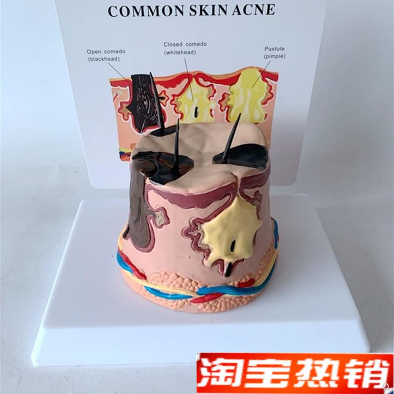 放大皮肤结构解剖模型组织层次皮肤构造J模型具微整形缝合美容教