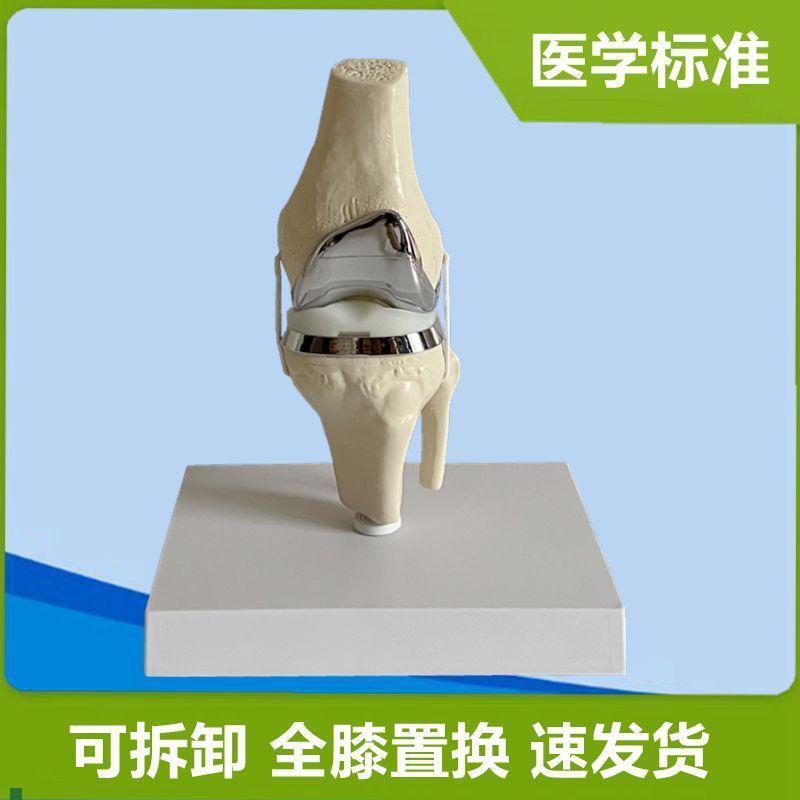 膝关节置换人工假肢替换半月板胫骨软骨膝盖手Q术演示临床骨科教