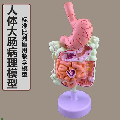 人体消化系统解剖模型大肠模型直肠十二指肠内脏肠W胃解剖构造模