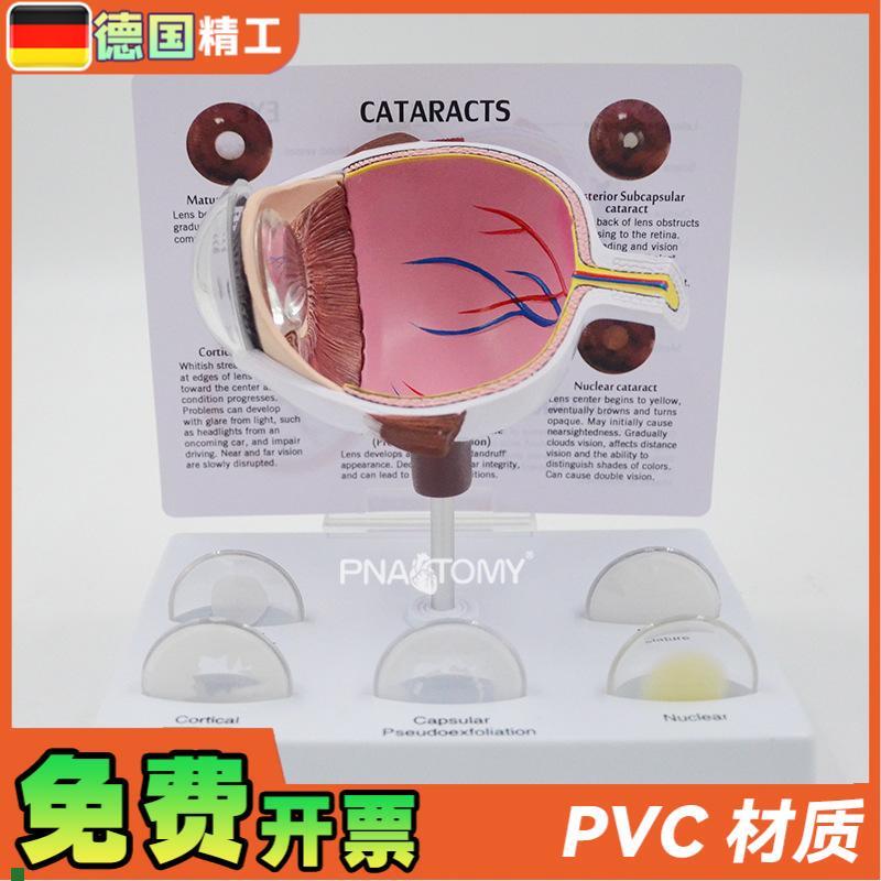 德国】眼球模型病理眼球演示教具眼科展示礼品人R体器官解剖模型