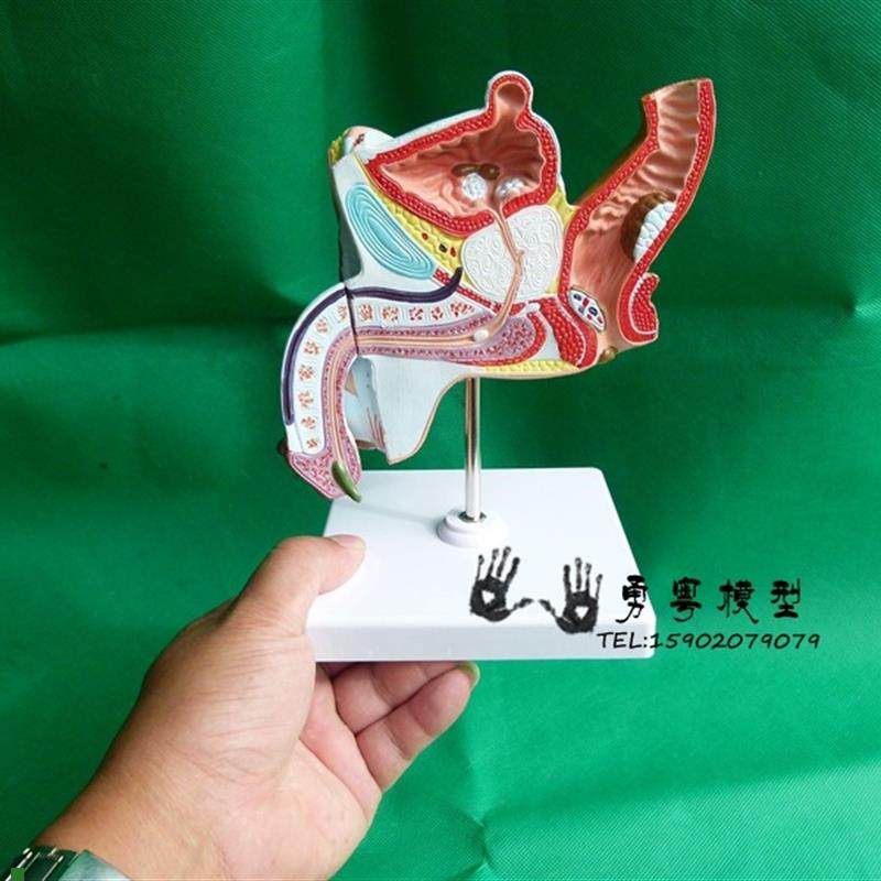 男性内生殖器病理模型病变生殖解剖模型男泌T尿系统疾病模型