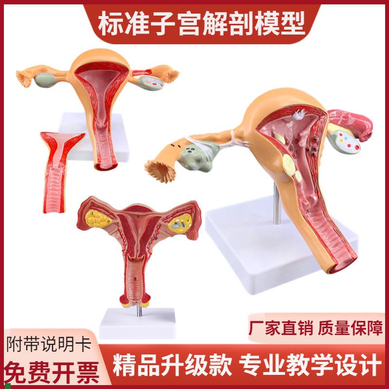 人体女性生d殖子宫解剖病理模型妇科生殖科教具阴道卵巢教学模型