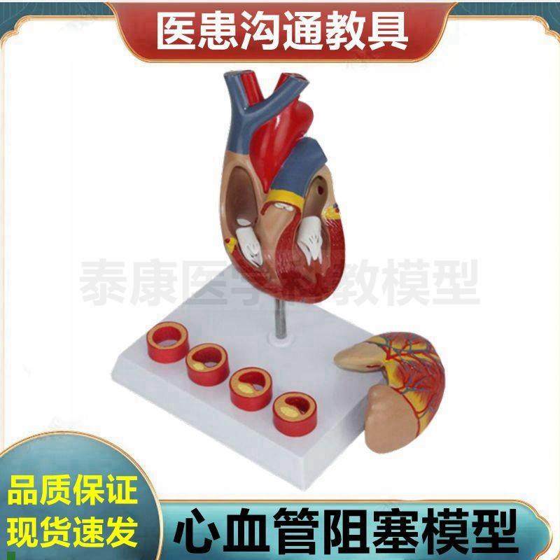 心脏血管阻塞模型冠状动脉管腔狭窄粥样脂肪斑块T硬化血压身高变
