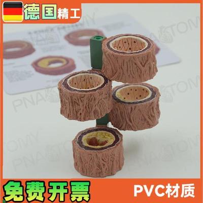 四阶段动脉血管模型粥样化演示教具血管硬化Q解剖展示模具礼品