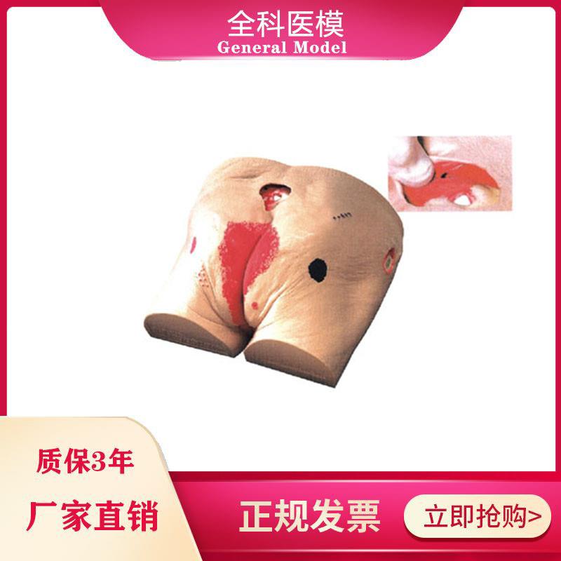 褥疮模型压疮伤口模型高级老年人压疮褥疮仿真护理W模型医教学用