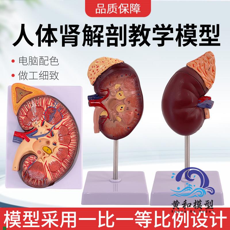 人体肾脏模型肾解剖附肾上腺y放大模型病变肾脏人体内脏器官解剖