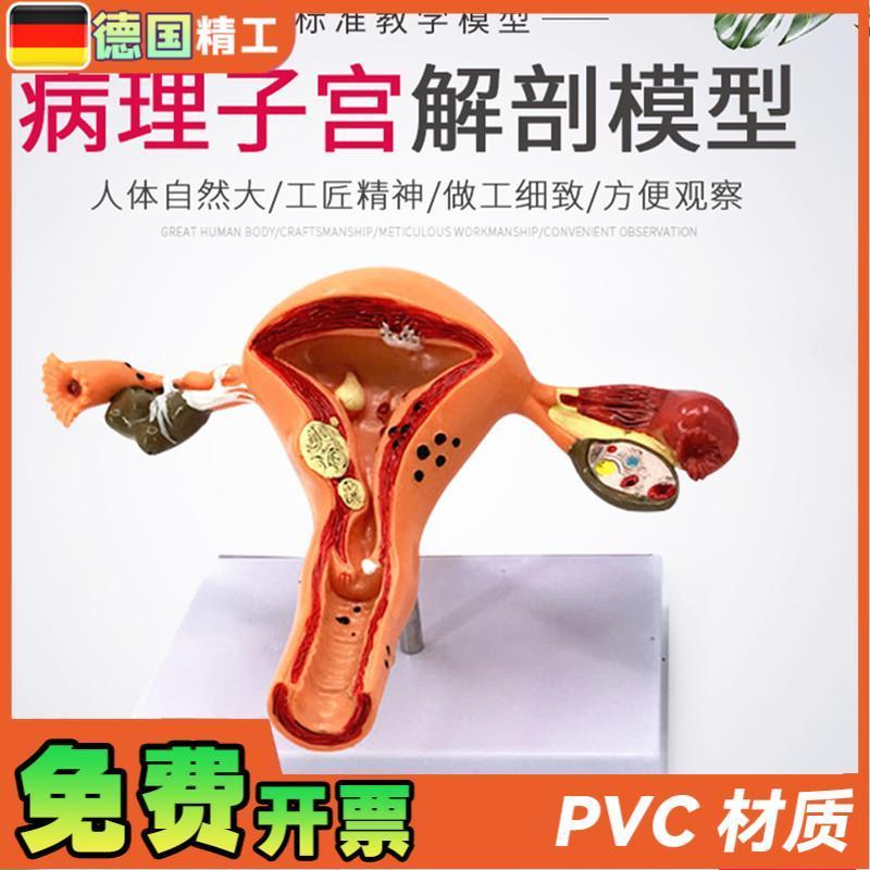 女性大子宫模型放大模型女性生殖解剖模型S计划生育示教模型