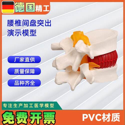 椎间盘模型人体腰椎突出病理演示模型11*1V0*7.6CM