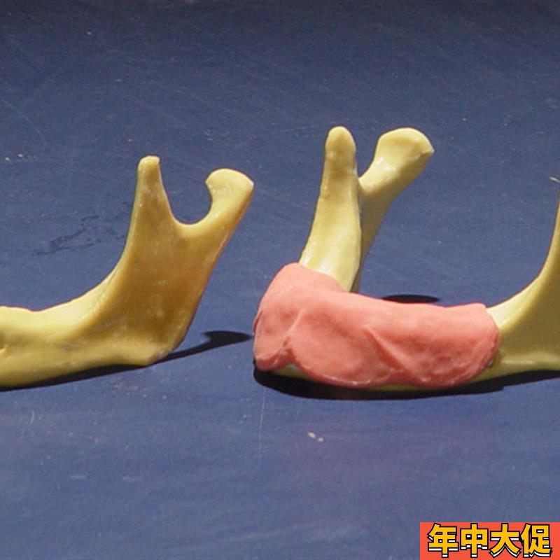 ENOVO颐诺下颌骨种植操作y模型口腔种植口腔齿科培训实训操作模
