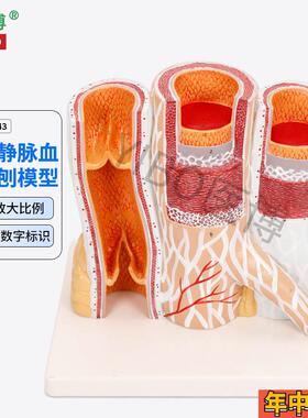 医博BIX-A3443动脉静脉血管y解刨模型人体血管解刨放大模型血管切