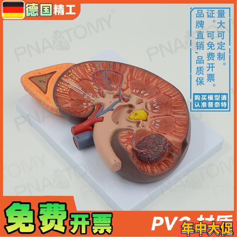 德国】人体肾脏内脏结构肾上腺解剖放大模型Q泌尿生殖系统男科泌