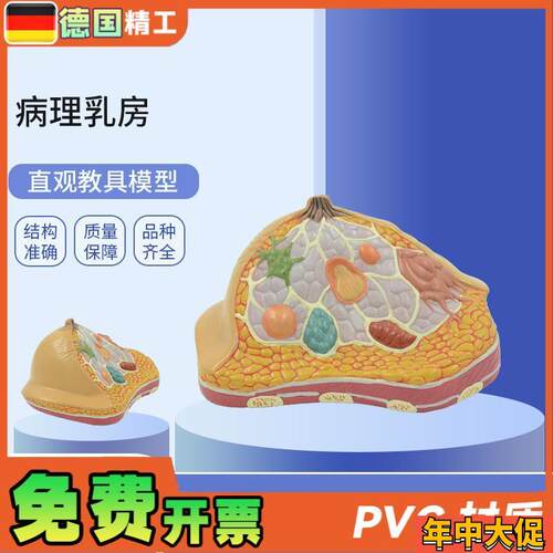 德国】PNT-0740妇科乳房解剖模型乳房病理解U剖乳房结构模型
