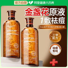 金盏花精华爽肤水湿敷控油祛痘科收缩毛孔颜去闭口晒后修复氏补水