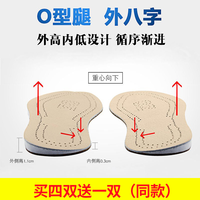 弓足垫o型腿矫正鞋垫外八字矫形成人男女足内外翻直腿纠正o形罗圈