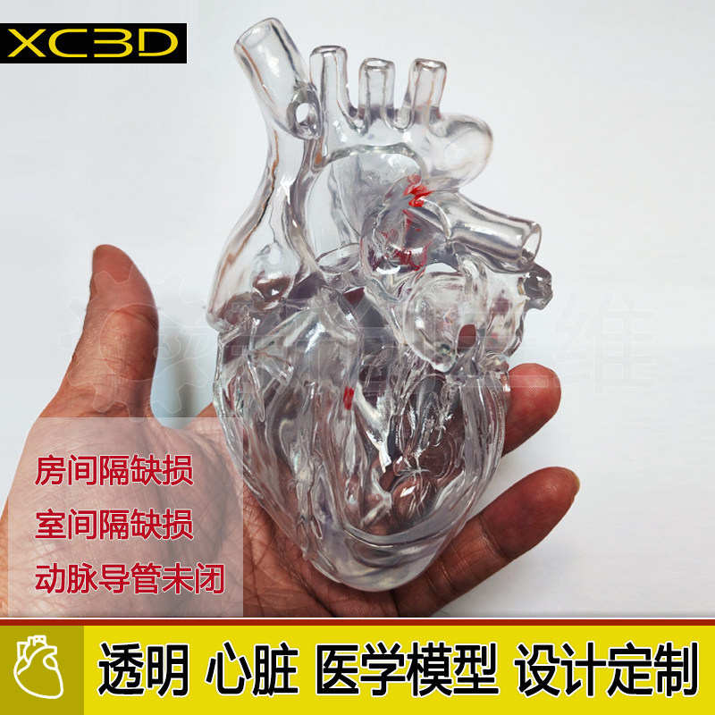 心脏结构畸形透明模型房间隔缺损室间隔缺损动脉导管未闭3D打印