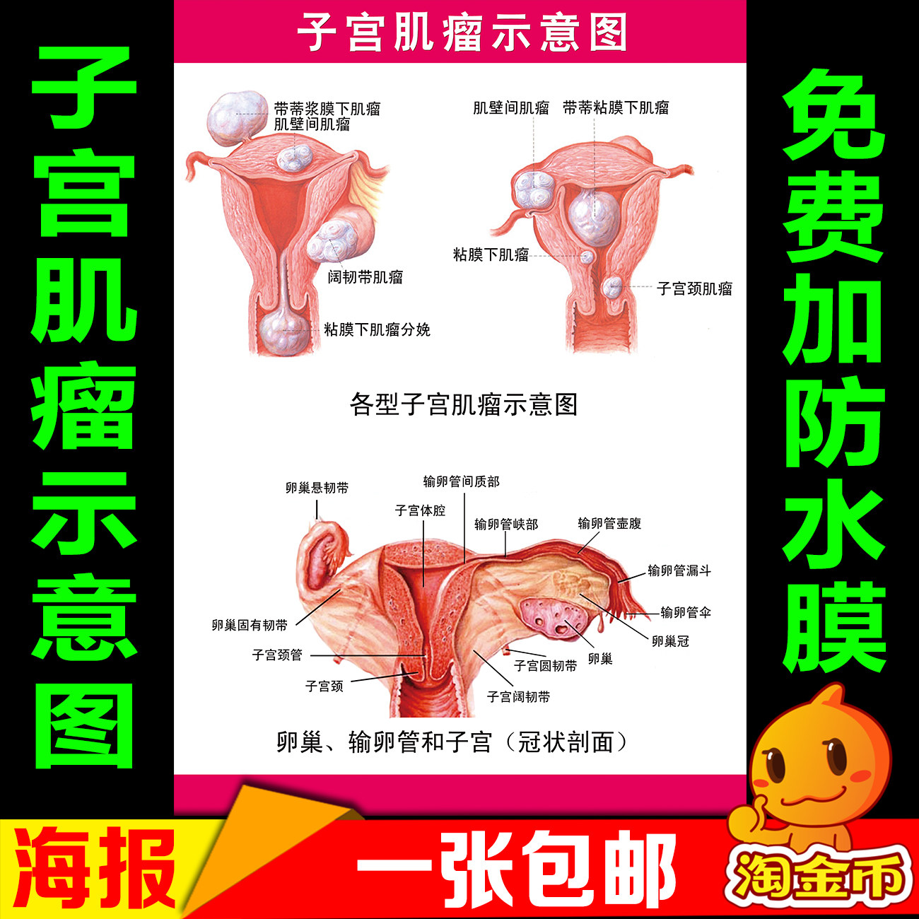 女性生殖器解剖图 医院宣传海报挂图 子宫肌瘤糜烂宫颈疾病示意图