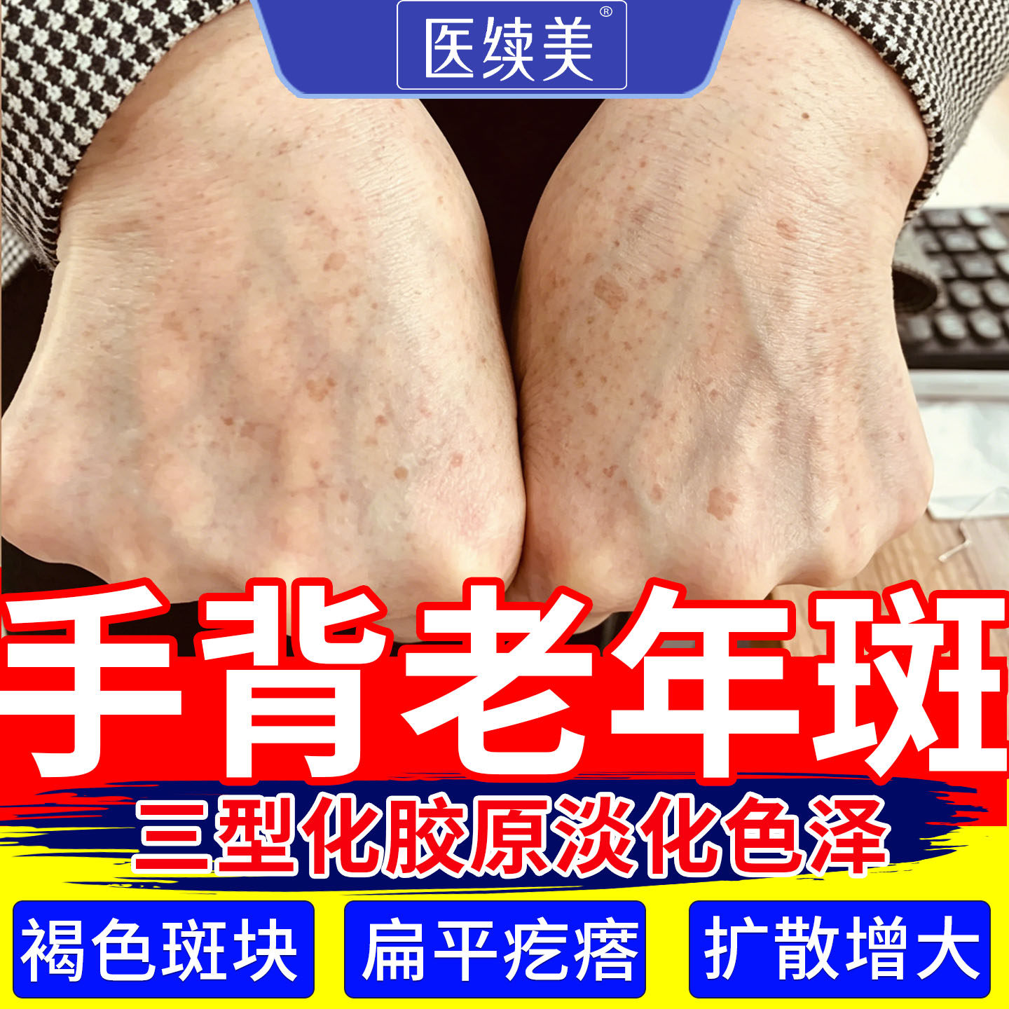 祛老年斑强力去除手部脸部老人斑专用霜黄褐斑可搭一擦就掉膏ZY