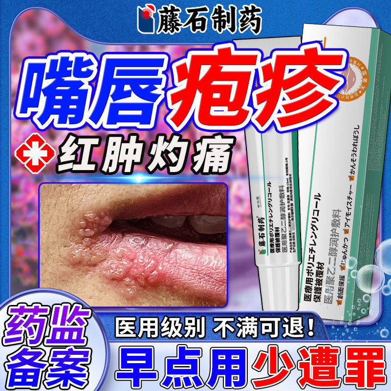 嘴唇单纯疱疹口唇嘴巴上火起泡烂嘴角水泡开裂药监备案膏BF