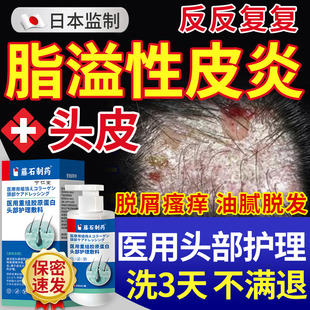 头皮脂溢性皮炎毛囊炎洗发水去脱屑止瘙痒抑真菌感染头癣喷剂MY