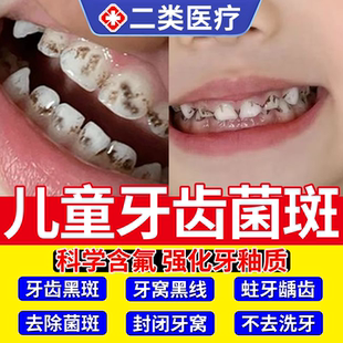儿童牙齿黑斑牙菌斑去祛除牙渍神器非显色牙膏黑线色素沉淀含氟YY