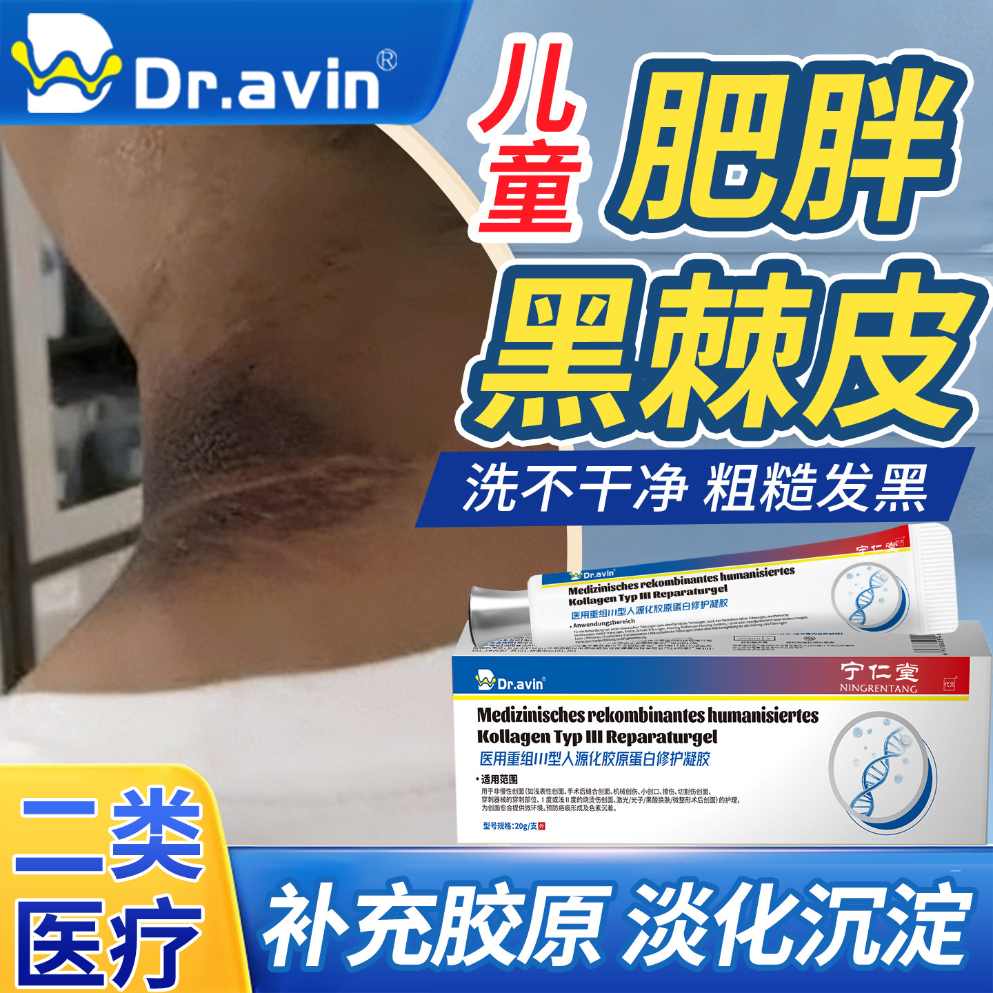 儿童去脖子黑棘皮药膏皮肤洗不干净黑色素沉淀肥胖后颈护理可搭AW