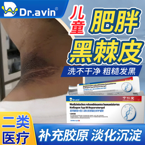 儿童去脖子黑棘皮药膏皮肤洗不干净黑色素沉淀肥胖后颈护理可搭FF