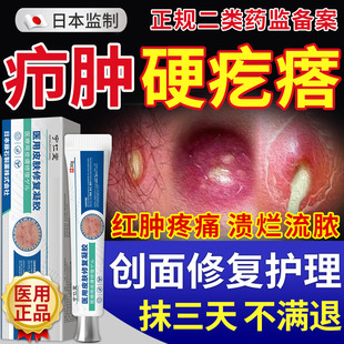 药监备案疖肿火疖子拔毒拔脓膏屁股上长脓包硬块结节囊肿敷料贴MY