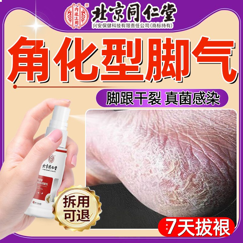 【北京同仁堂】角化型脚气喷雾剂