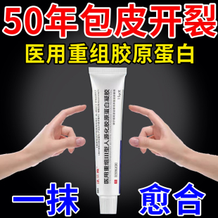 包皮开裂发炎红肿小裂口子包皮炎特效药专用药膏龟头炎系带撕裂WW