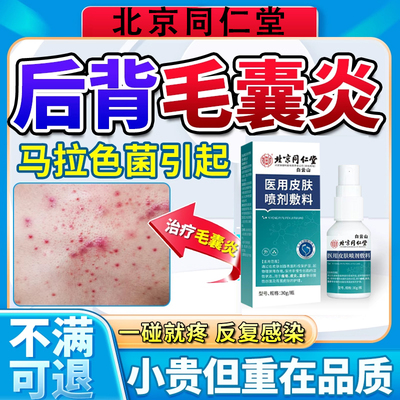 背后长痘痘后背毛囊炎喷剂