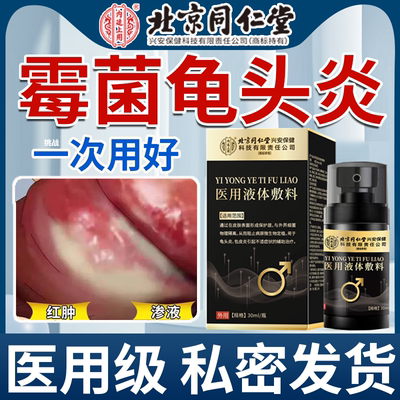 北京同仁堂霉菌性龟头炎专用型
