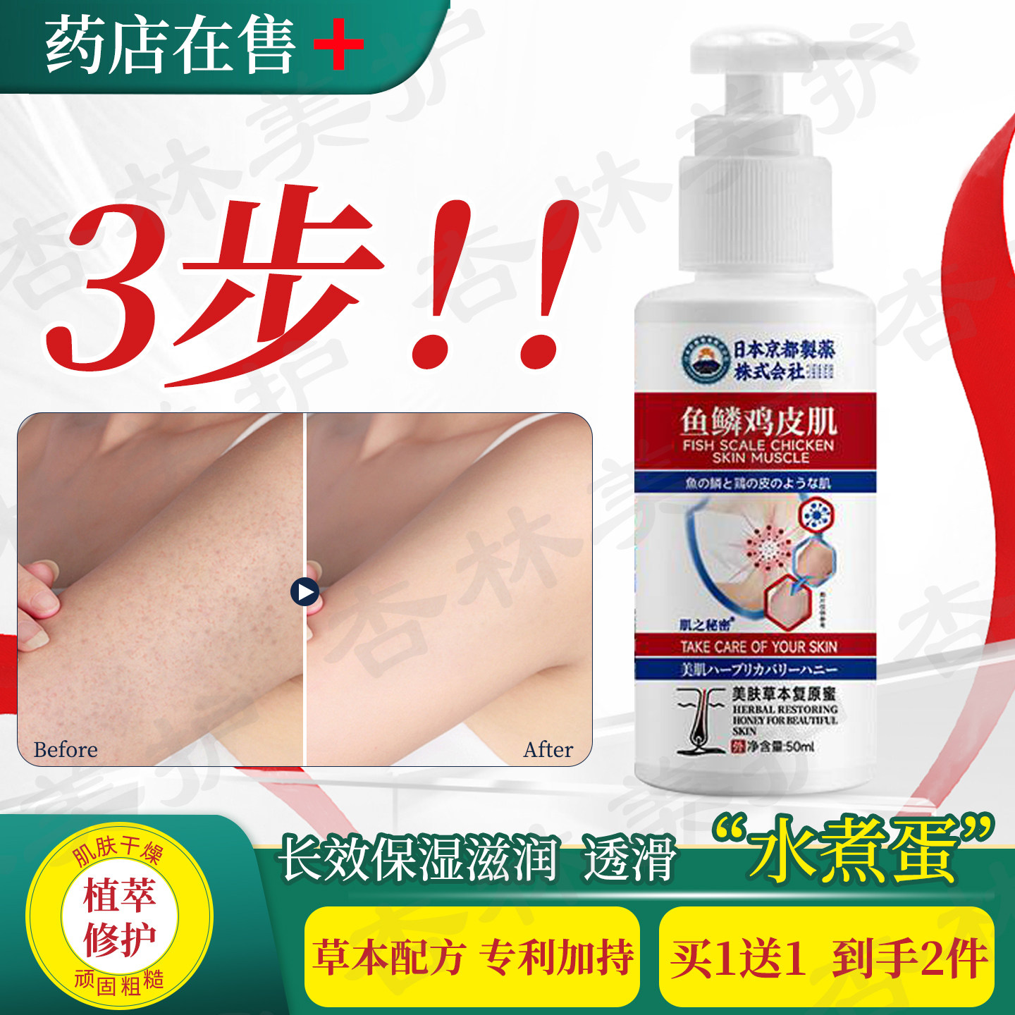 维a酸乳胶膏疙瘩毛囊角化身体乳霜果酸沐浴露去除鱼鳞鸡皮肤日本