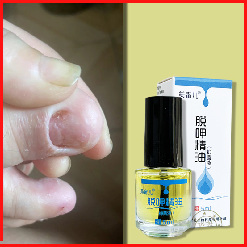 软甲液脱甲精油涂抹坏甲厚甲自然美甲工具