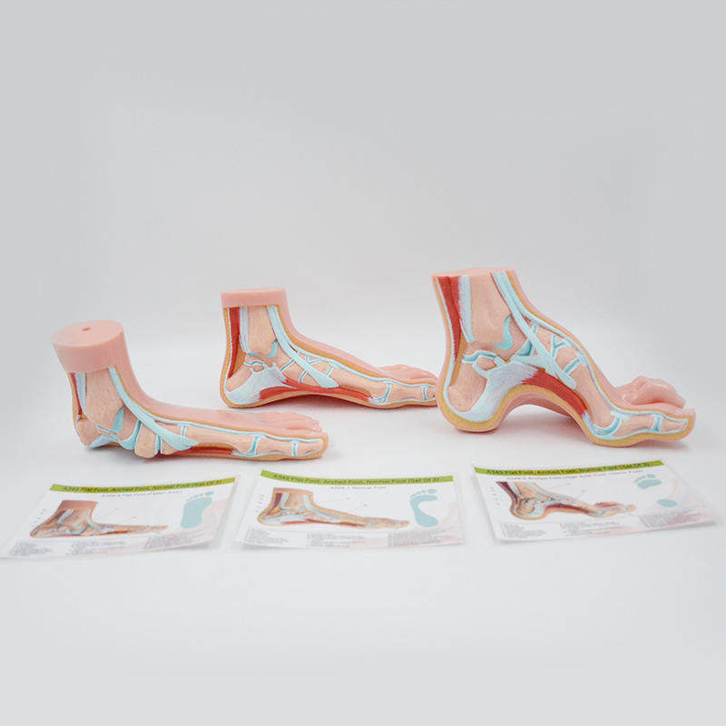 pnt-1727b正常足扁平足弓形足模型/足弓模型 解剖模型 脚模型