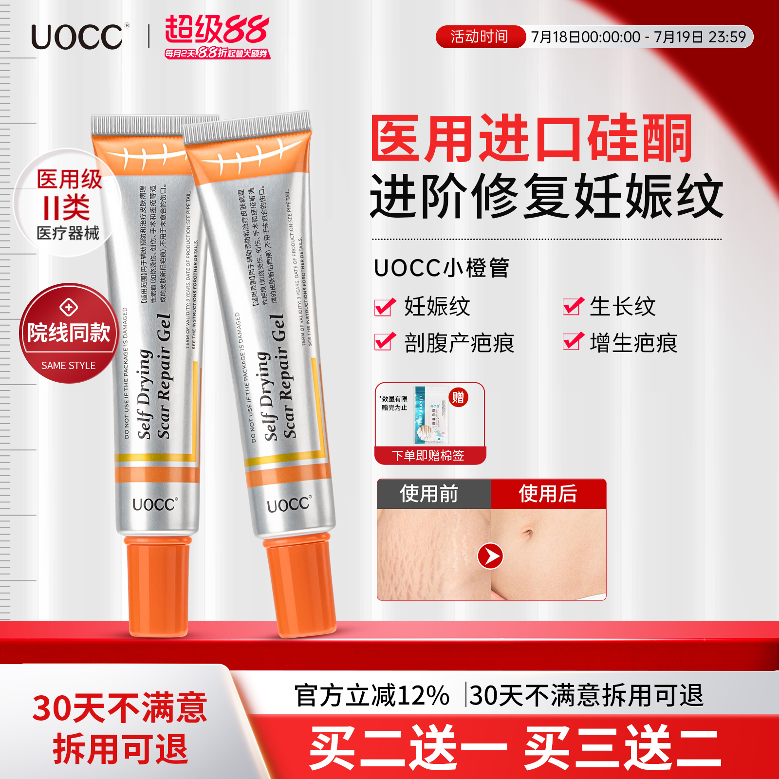 uocc小橙管硅酮凝胶修复膏辅料淡化妊娠纹生长纹疤痕医用增生去疤
