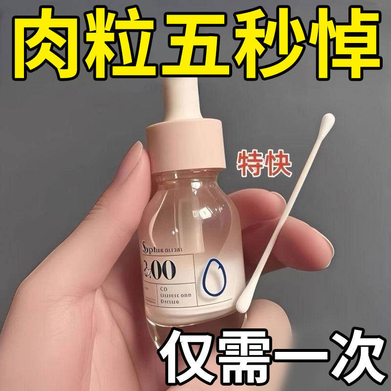 尤立净官方旗舰店克尤瘊肉粒疙瘩一抹无忧除扁平跖尤专正品用膏药