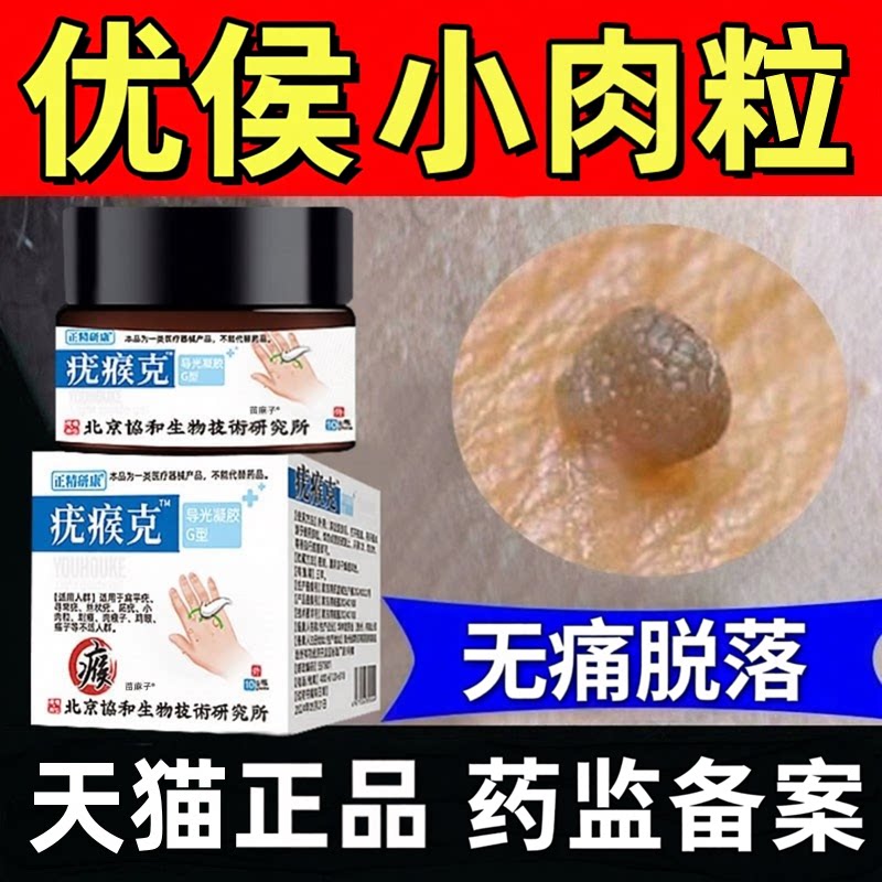 扁平去忧药膏祛跖脖子上长的小肉粒优疙瘩瘊猴去除膏优子一抹灵