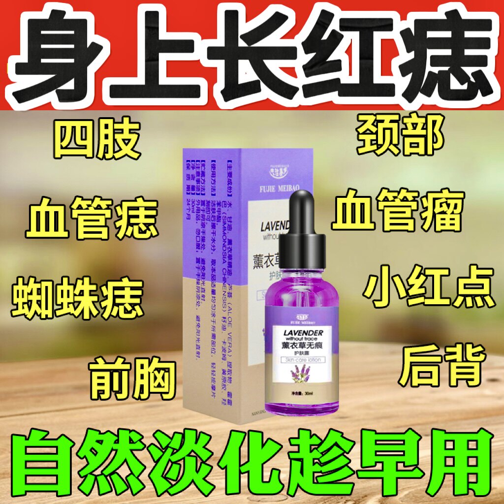 血管痣去除血管瘤婴儿专用药膏身上红痣点樱桃草莓状红血丝抑菌液