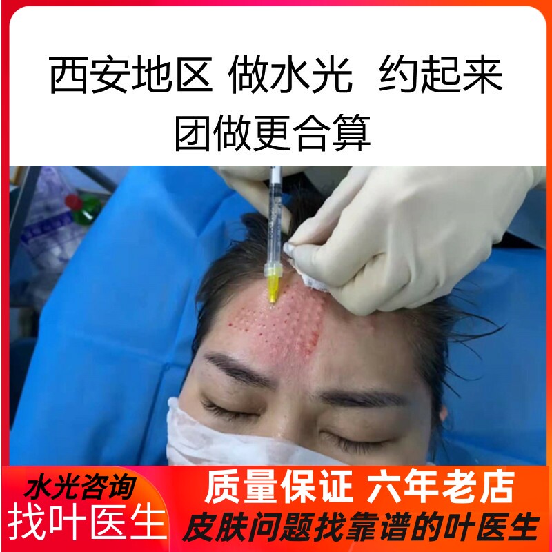 叶医生打水光以及产品和教材